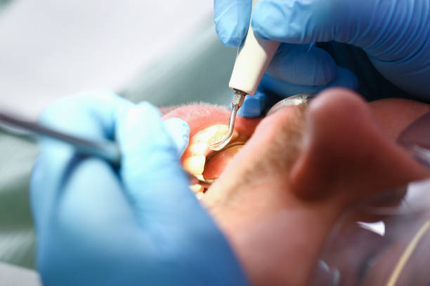 Emergency Gum Pain Relief in MA